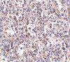 Immunohistochemistry of SCARB1 in human spleen tissue with SCARB1 antibody at 2.5 ug/mL.