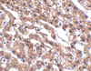 Immunohistochemistry of MACC1 in human liver tissue with MACC1 antibody at 2.5 ug/mL.