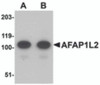 Western blot analysis of AFAP1L2 in mouse liver tissue lysate with AFAP1L2 antibody at (A) 1 and (B) 2 &#956;g/mL.