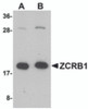 Western blot analysis of ZCRB1 in Raji cell lysate with ZCRB1 antibody at (A) 1 and (B) 2 &#956;g/mL.