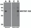 Western blot analysis of Hemaggutinin using recombinant seasonal Hemagglutinin (lanes A & B) and swine-origin Hemagglutinin (lanes C & D) with anti-seasonal Hemagglutinin antibody (5231) at 2 &#956;g/mL (lanes A & C) and anti-swine-origin Hemagglutinin antibody (5233) at 2 &#956;g/mL (lanes B & D) .