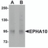 Western blot analysis of EphA10 in 293 cell lysate with EphA10 antibody at (A) 1 &#956;g/mL and (B) 2 &#956;g/mL.