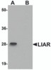Western blot analysis of LIAR in mouse kidney tissue lysate with LIAR antibody at 1 &#956;g/mL in (A) the absence and (B) the presence of blocking peptide.
