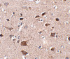 Immunohistochemistry of CCDC134 in human brain tissue with CCDC134 antibody at 2.5 ug/mL.