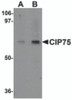 Western blot analysis of CIP75 in 3T3 cell lysate with CIP75 antibody at (A) 1 and (B) 2 &#956;g/mL.