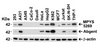Figure 1 Independent Antibody Validation (IAV) via Protein Expression Profile in Human Cell Lines
Loading: 15 &#956;g of lysates per lane.
Antibodies: MPYS 5269 (1 &#956;g/mL) , MPYS 64-236 (2 &#956;g/mL) and beta-actin 3779 (1 &#956;g/mL) , 1h incubation at RT in 5% NFDM/TBST.
Secondary: Goat anti-rabbit IgG HRP conjugate at 1:10000 dilution.