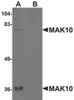 Western blot analysis of MAK10 in rat heart tissue lysate with MAK10 antibody at 1 &#956;g/mL in the (A) absence and (B) presence of blocking peptide.