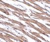 Immunohistochemistry of MAK10 in human heart tissue with MAK10 antibody at 2.5 ug/mL.