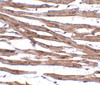 Immunohistochemistry of MAK10 in human heart tissue with MAK10 antibody at 5 ug/mL.