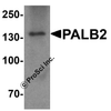 Western blot analysis of PALB2 in SK-N-SH cell lysate with PALB2 antibody at 1 &#956;g/mL.