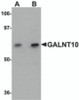 Western blot analysis of GALNT10 in SK-N-SH cell lysate with GALNT10 antibody at (A) 1 and (B) 2 &#956;g/mL.