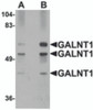 Western blot analysis of GALNT10 in rat brain tissue lysate with GALNT10 antibody at (A) 1 and (B) 2 &#956;g/mL.