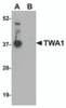 Western blot analysis of TWA1 in human brain tissue lysate with TWA1 antibody at 1 &#956;g/mL in (A) the absence and (B) the presence of blocking peptide.