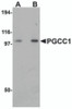 Western blot analysis of PGCC1 in rat thymus tissue lysate with PGCC1 antibody at (A) 0.5 and (B) 1 &#956;g/mL.