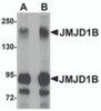 Western blot analysis of JMJD1B in rat liver tissue lysate with JMJD1B antibody at (A) 1 and (B) 2 &#956;g/mL.
