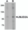 Western blot analysis of JMJD2A in rat liver tissue lysate with JMJD2A antibody at (A) 1 and (B) 2 &#956;g/mL.