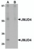 Western blot analysis of JMJD4 in human spleen tissue lysate with JMJD4 antibody at 1 &#956;g/mL in (A) the absence and (B) the presence of blocking peptide.