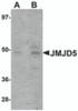 Western blot analysis of JMJD5 in human liver tissue lysate with JMJD5 antibody at (A) 1 and (B) 2 &#956;g/mL.