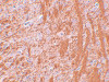 Immunohistochemistry of JMJD6 in rat brain tissue with JMJD6 antibody at 2.5 ug/mL.