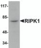 Western blot analysis of RIPK1 in rat kidney tissue lysate with RIPK1 antibody at 1 &#956;g/mL.