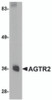 Western blot analysis of AGTR2 in mouse liver tissue lysate with AGTR2 antibody at 0.5 &#956;g/mL.