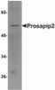 Western blot analysis of Prosapip2 in rat liver tissue lysate with Prosapip2 antibody at 1 &#956;g/mL.