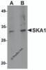 Western blot analysis of SKA1 in A549 cell lysate with SKA1 antibody at (A) 0.5 and (B) 1 &#956;g/mL.