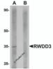 Western blot analysis of RWDD3 in rat kidney tissue lysate with RWDD3 antibody at 1 &#956;g/mL in (A) the absence and (B) the presence of blocking peptide.