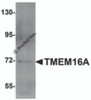Western blot analysis of TMEM16A in A549 cell lysate with TMEM16A antibody at 1 &#956;g/mL.