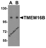 Western blot analysis of TMEM16B in human small intestine tissue lysate with TMEM16B antibody at (A) 1 and (B) 2 &#956;g/mL.