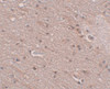 Immunohistochemistry of TMEM16B in human brain tissue with FRMPD4 antibody at 5 ug/mL.