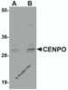 Western blot analysis of CENPO in mouse kidney tissue lysate with CENPO antibody at (A) 1 and (B) 2 &#956;g/mL.