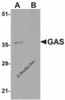 Western blot analysis of GAS in EL4 cell lysate in (A) the absence and (B) the presence of blocking peptide with GAS antibody at 1&#956;g/mL.