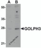 Western blot analysis of GOLPH3 in rat lung tissue lysate with GOLPH3 antibody at (A) 0.5 and (B) 1 &#956;g/mL.