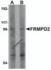 Western blot analysis of FRMPD2 in rat kidney tissue lysate with FRMPD2 antibody at (A) 1 and (B) 2 &#956;g/mL.