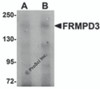 Western blot analysis of FRMPD3 in Jurkat cell lysate with FRMPD3 antibody at (A) 1 and (B) 2 &#956;g/mL.