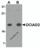 Western blot analysis of OCIAD2 in A549 cell lysate with OCIAD2 antibody at (A) 0.5 and (B) 1 &#956;g/mL.