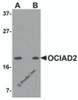 Western blot analysis of OCIAD2 in SK-N-SH cell lysate with OCIAD2 antibody at (A) 0.5 and (B) 1 &#956;g/mL.
