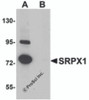 Western blot analysis of SRPX1 in SK-N-SH cell lysate with SRPX1 antibody at 0.25 &#956;g/mL in (A) the absence and (B) the presence of blocking peptide.