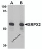 Western blot analysis of SRPX2 in human lung tissue lysate with SRPX2 antibody at (A) 1 and (B) 2 &#956;g/mL.