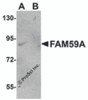Western blot analysis of FAM59A in rat liver tissue lysate with FAM59A antibody at 1 &#956;g/mL in (A) the absence and (B) the presence of blocking peptide.