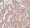 Immunohistochemistry of PLEKHM3 in human brain tissue with PLEKHM3 antibody at 5 ug/mL.