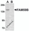 Western blot analysis of FAM59B in SK-N-SH cell lysate with FAM59B antibody at 1 &#956;g/mL in (A) the absence and (B) the presence of blocking peptide.