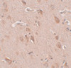 Immunohistochemistry of FAM59B in human brain tissue with FAM59B antibody at 5 ug/mL.