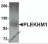 Western blot analysis of PLEKHM1 in human lung tissue lysate with PLEKHM1 antibody at 1 &#956;g/mL.