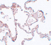 Immunohistochemistry of PLEKHM1 in human lung tissue with PLEKHM1 antibody at 5 ug/mL.