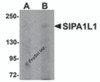 Western blot analysis of SIPA1L1 in rat brain tissue lysate with SIPA1L1 antibody at (A) 0.5 and (B) 1 &#956;g/mL.