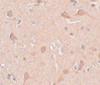 Immunohistochemistry of SIPA1L1 in human brain tissue with SIPA1L1 antibody at 5 ug/mL.