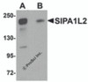 Western blot analysis of SIPA1L2 in rat brain tissue lysate with SIPA1L2 antibody at 1 &#956;g/mL in (A) the absence and (B) the presence of blocking peptide.
