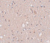 Immunohistochemistry of SIPA1L2 in human brain tissue with SIPA1L2 antibody at 5 ug/mL.